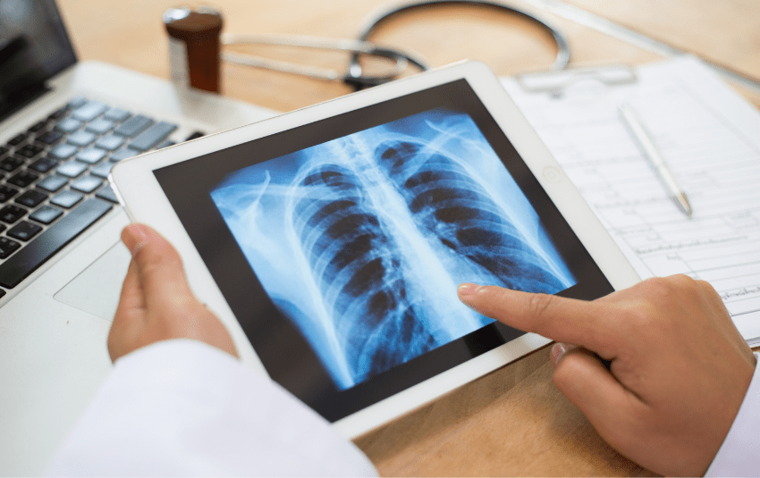 Doctor reviewing x-ray of patient's chest
